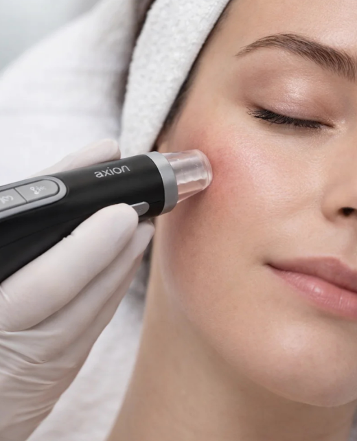 Maison Beauty Lounge_Mesoesthetic Microneedling Axion
